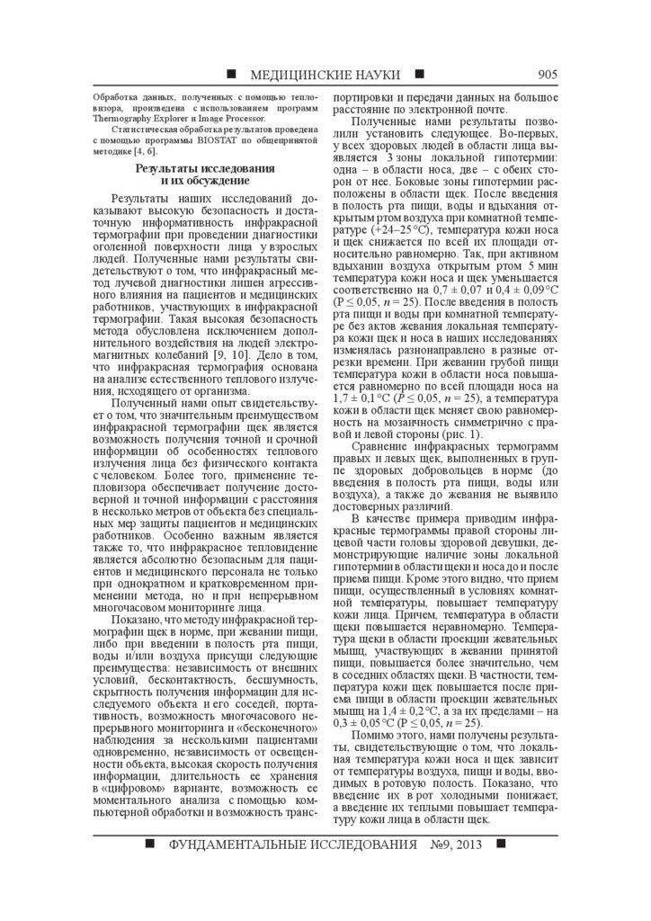 Инфракрасная термография